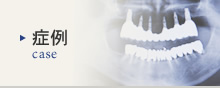 症例 case